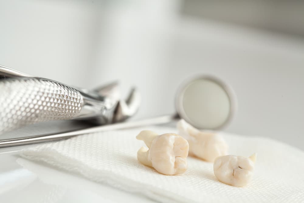 Outils d'extraction dentaire